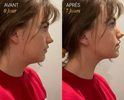 Brosse lymphatique Vyoom pour le visage