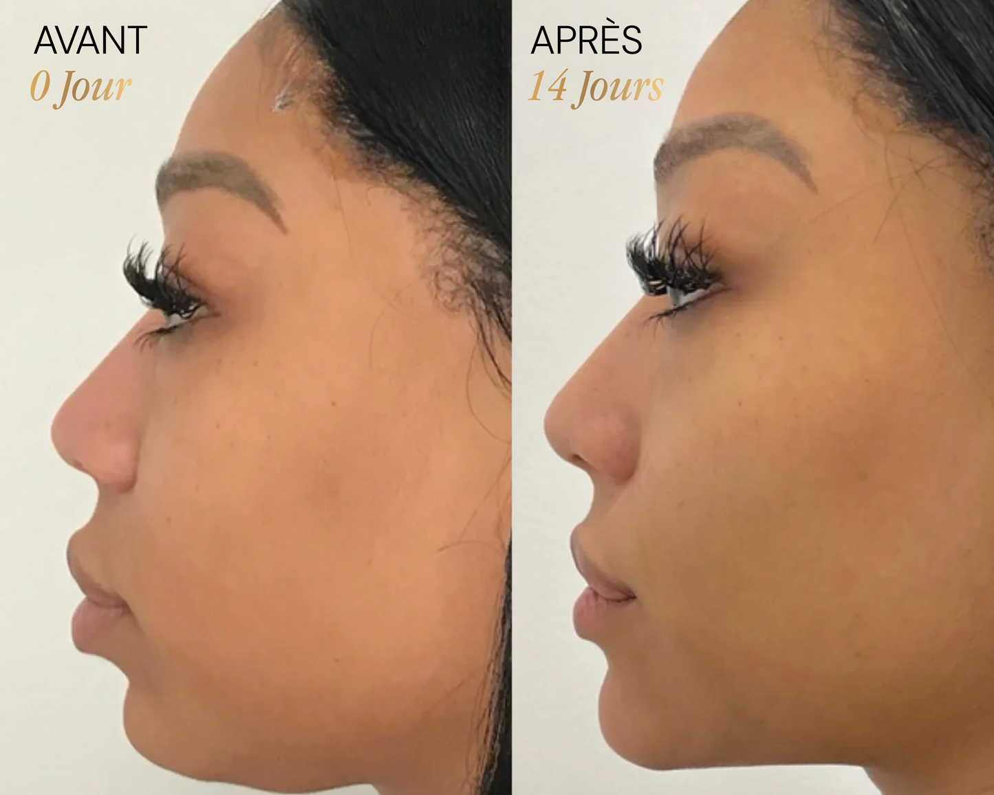 Brosse lymphatique Vyoom pour le visage