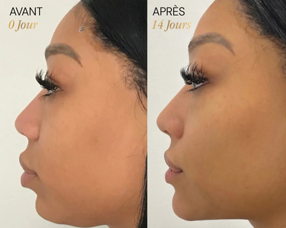 Brosse lymphatique Vyoom pour le visage