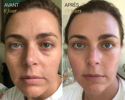 Brosse lymphatique Vyoom pour le visage