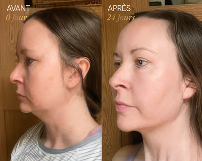 Brosse lymphatique Vyoom pour le visage