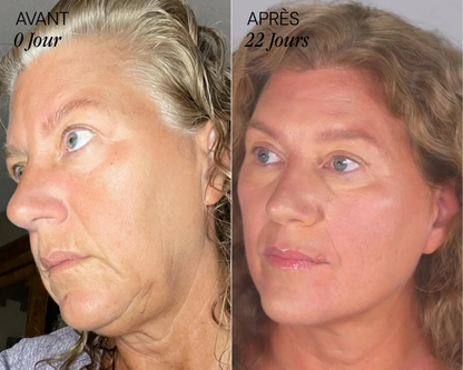 Brosse lymphatique Vyoom pour le visage