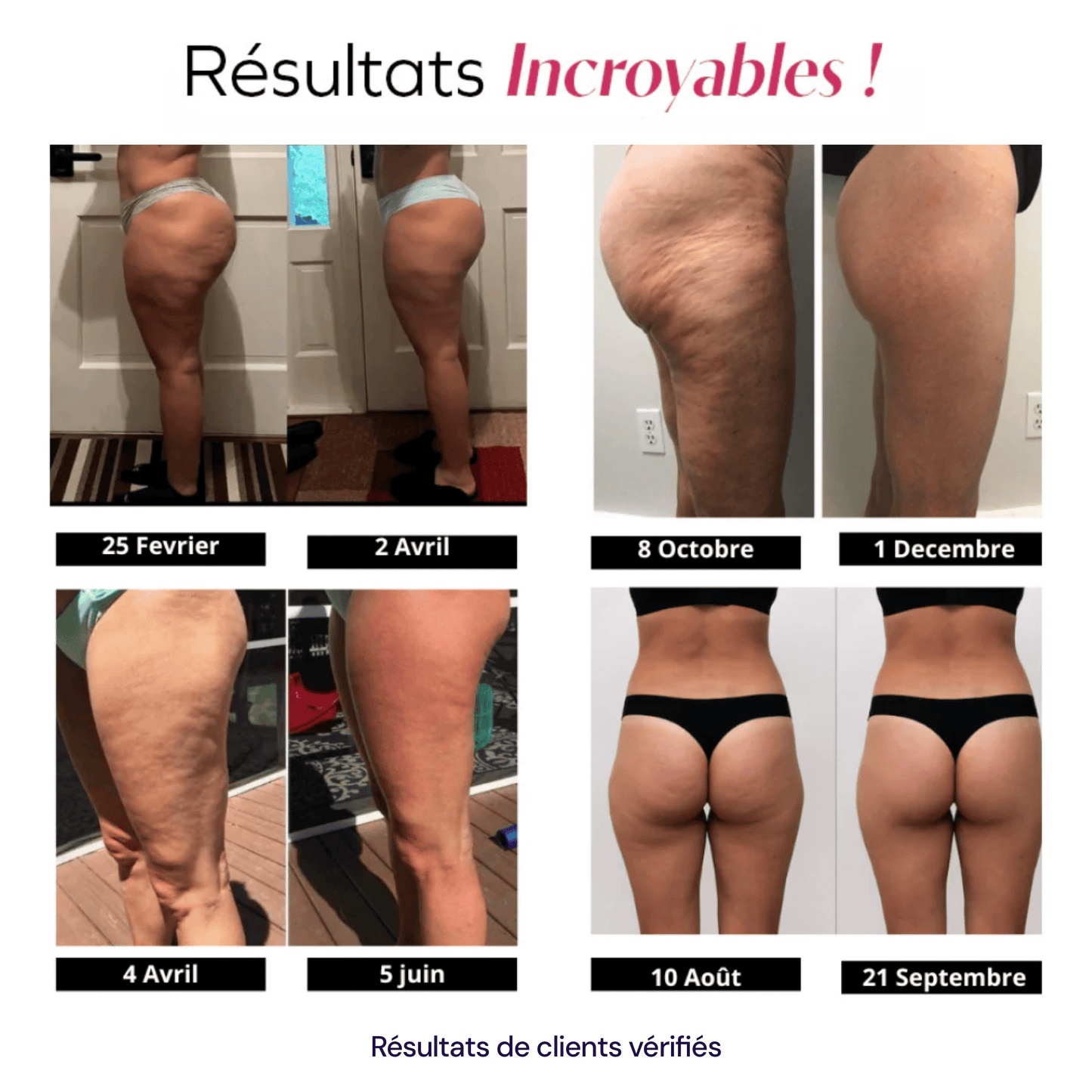 Legging 3D Anti-Cellulite