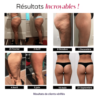 Legging 3D Anti-Cellulite